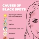 All about Brown Spots, Freckles, Melasma, Pigmentation