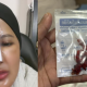 Nilam Ortiz keluarkan silikon hidung, plan nak buang tatu