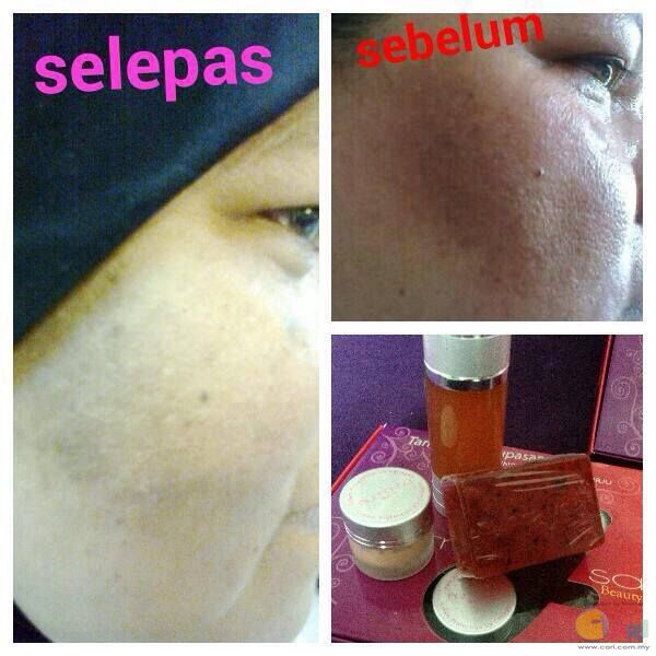 Sabun collagen nurraysa RM29 (MULAI 1 nov 2015 SEHINGGA 15 