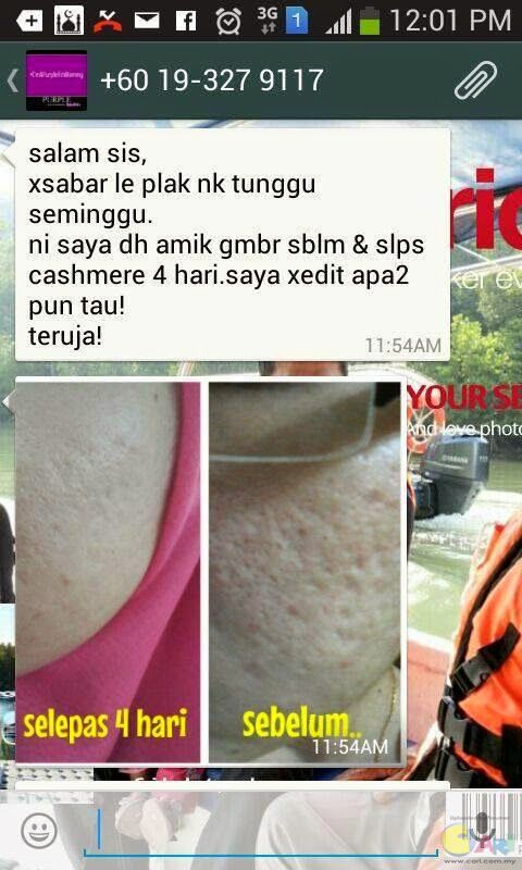 Cashmere Serum Terbaik Fesyen Tips Penjagaan Diri Wanita Lelaki Forum Cari Infonet Mobile Powered By Discuz