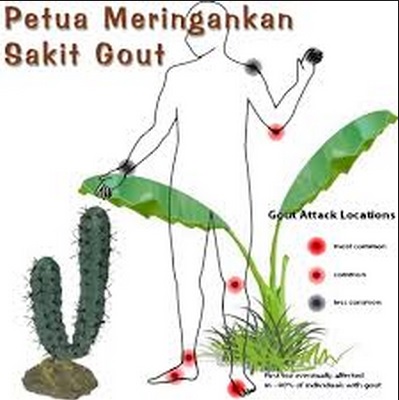 Petua Untuk Sakit Gout - Perubatan - Kesihatan - Forum 