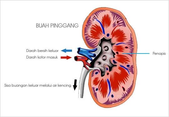 31+ Foto Kartun Sakit Pinggang - Gambar Kartun