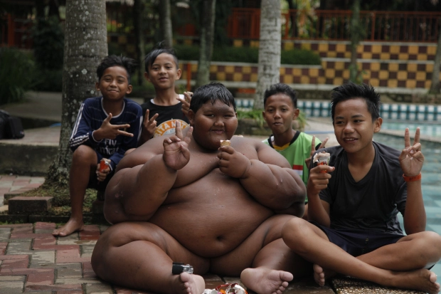 This morbidly obese boy weighs 30st at just 10 years old