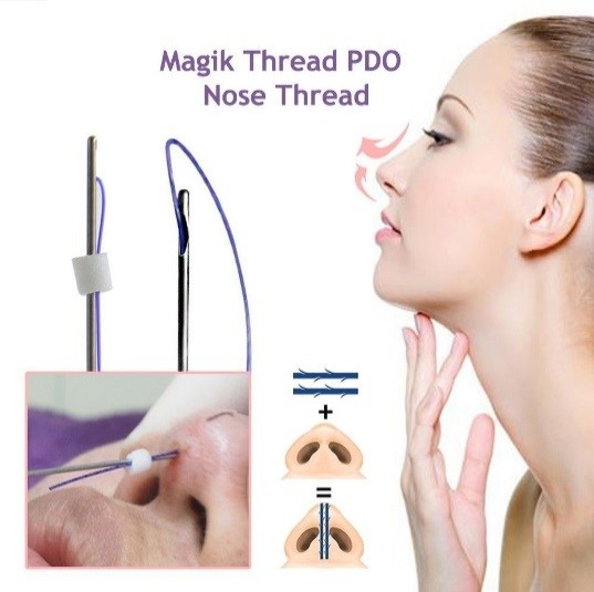 Nose-threading-with-PDO-threads.jpg