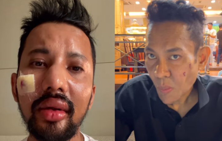 Pukul Razman Razmi, Aqo Imran berdepan hukuman penjara 10 tahun