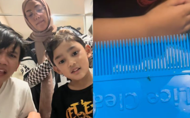 Baru seminggu pergi sekolah, dah penuh kutu anak Shila Amzah