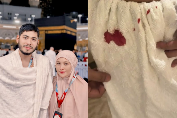 Kain Ihram Berdarah, Mamat Tak Sedar Terluka Ketika Berasak Cium Hajar Aswad