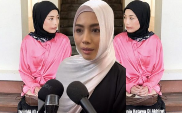 Linda Hashim kongsi gambar muka lebam-lebam