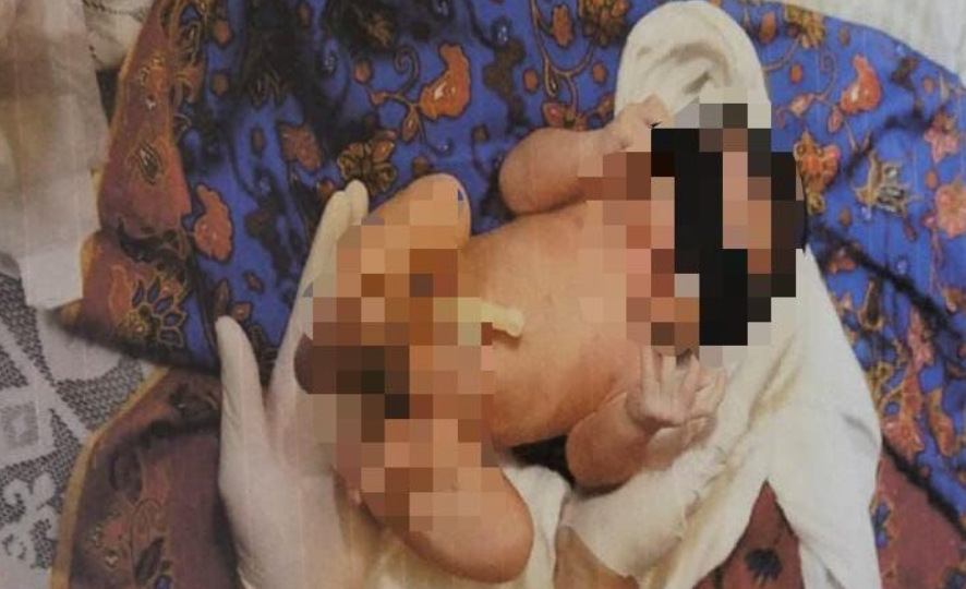 Dibalut kain batik, kotor dan bersemut- bayi dibuang depan rumah orang