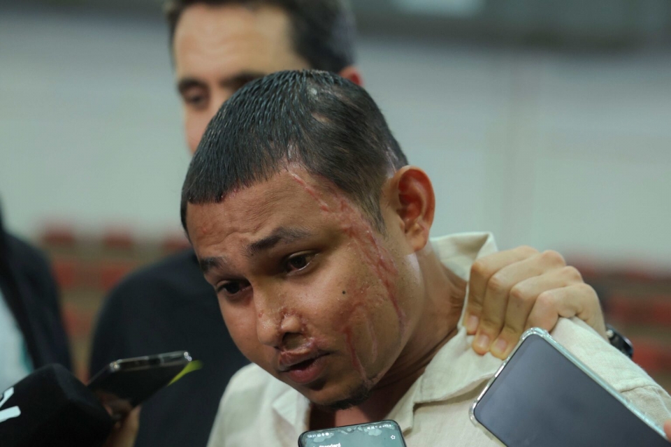 Kes simbah asid Faisal Halim diklasifikasi ‘tiada tindakan lanjut’