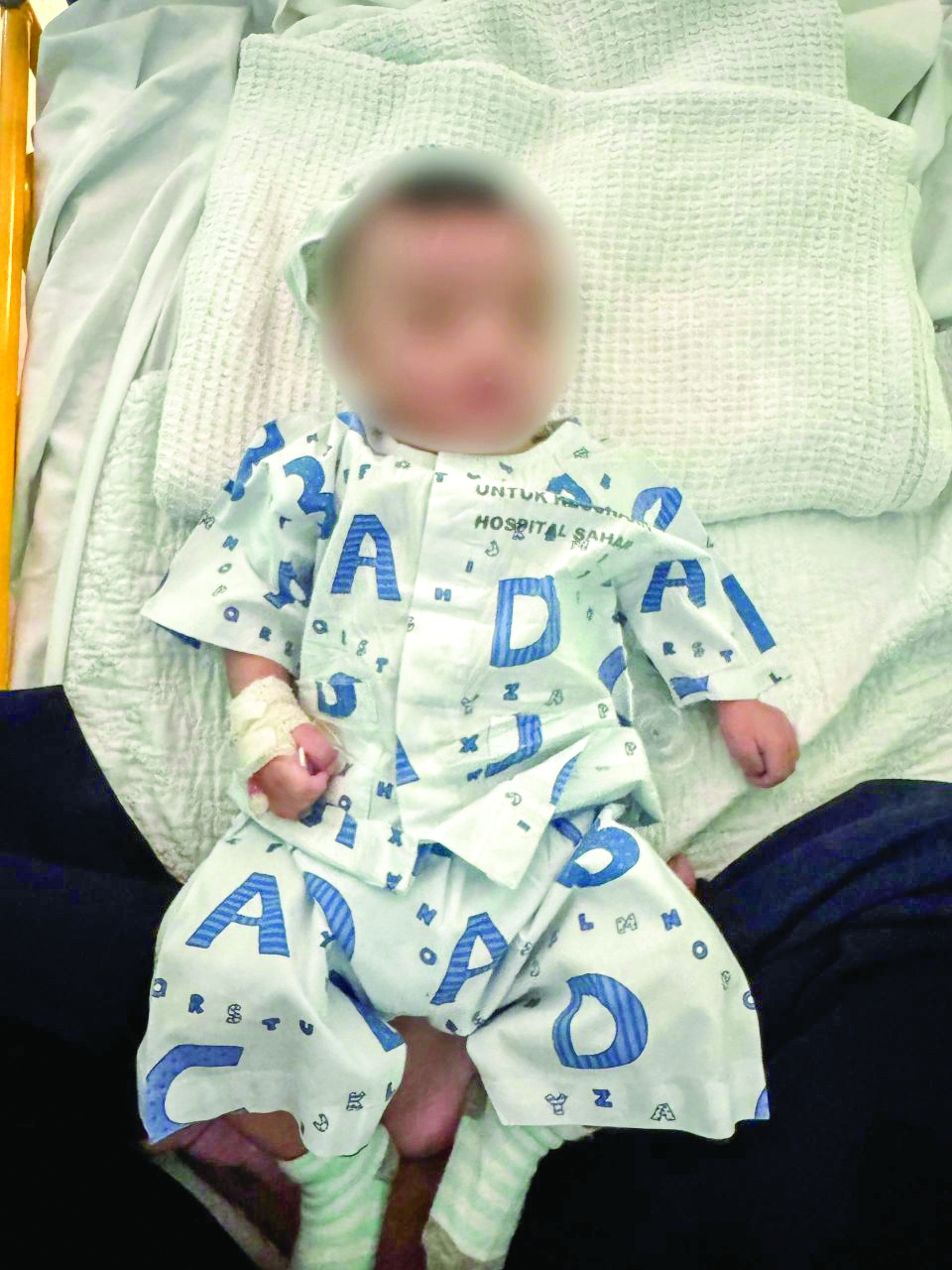 Trauma bayi cedera ketika dijaga pengasuh