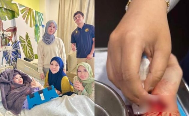 Anak Bonda Rozita Dimasukkan Ke Hospital, Tangan Luka Terkena Pisau ‘Blender’ – ‘Salah Satu Saraf Putus’