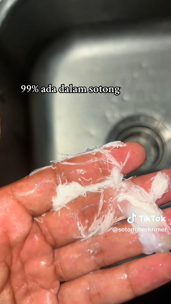 Bergerak-Gerak Kat Tangan, Cacing Halus 99% Ada Dalam Sotong!