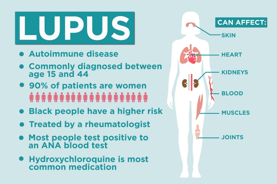 Scammer Hidap Penyakit Lupus, Stres Buat Keadaan Lebih Teruk, Cari Ubat Tanpa Steroid Untuk Jangka Panjang!
