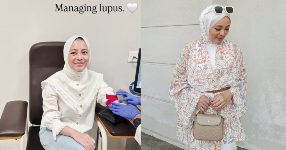 [Edisi Cash?] Vivy Scammer Yusof Hidap Penyakit Lupus!