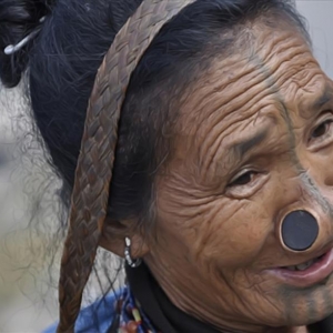 Unik! Wanita Tanpa Lubang Hidung