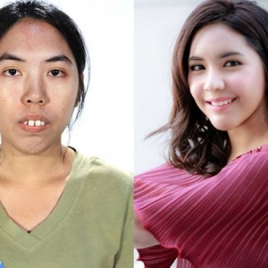 Wanita Thailand Berubah Rupa Sekelip Mata