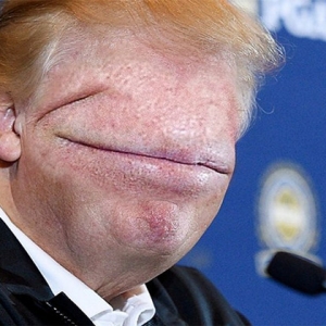 Mana Pergi Hidung Dan Mata Donald Trump?