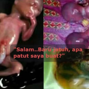 "Janin Masih Berdenyut Dalam Kantung" - 'Bunuh' Anak Macam Bunuh Nyamuk