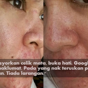 Gara-gara Dambakan Wajah 'Flawless', Habis Wajah Wanita Ini Bergerutu