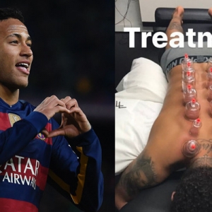 Kembali Beraksi, Neymar Ditemui Menjalani Rawatan Bekam