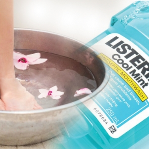 Gelinya Kaki Kering Dan Berkerak, Air Rendaman Listerine Boleh Tolong