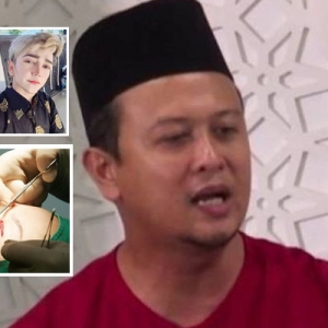 Islam Larang lakukan Bedah Hanya Kerana Malu Dihina-  Syamsul Debat