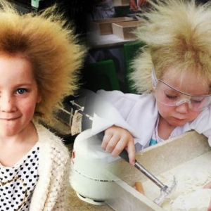 Einstein Junior! Kanak-kanak Ini Alami Sindrom Rambut Menggerbang