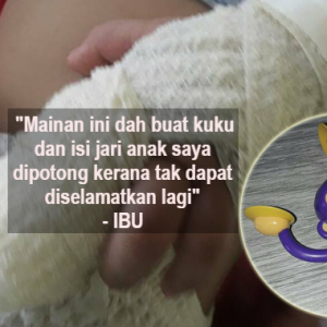 Kerana 'Monyet' Ini, Kuku Dan Isi Jari Anak Terpaksa Dipotong