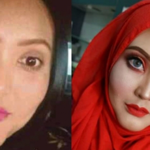 Padah Cucuk Kolagen, Wanita Malu Digelar Muka Firaun