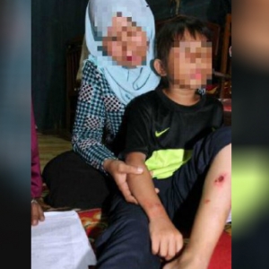 Toreh Anak, Hanya Kerana Muka Seiras Bekas Isteri