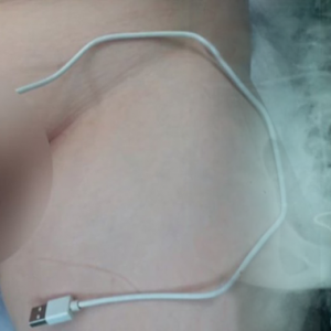 Yang Pergi Masukkan Kabel USB Dalam Zakar Tu, Kenapa Dik?