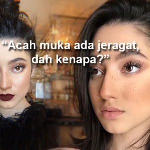 "Muka Dia, Kau Pula Yang Panas?" - Netizen Puji 'Freckles' Palsu Ameera Khan