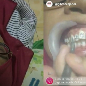 Doktor Fake Braces Semakin 'Mengganas', Kali Ini Siap Buat Live Di Instagram