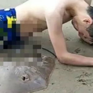 Kemaluan Ditusuk Duri Ikan Pari, 'Melekat' Sampai Ke Pantai