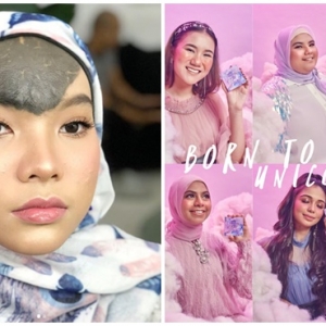 "Terbaik Bosku," Tanda Lahir Penuh Di Dahi, Tak Halang Gadis Ini Jadi Model Produk Kecantikan