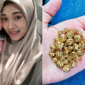 Nak Bagi Anak Melawa Dengan Gelang Emas, Tapi Tumbesaran Tangan Anak Terbantut!