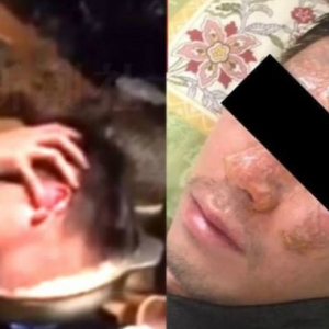 Celup Muka Pekerja Dalam Sup Mendidih, Bos Kata Hanya Prank Sahaja