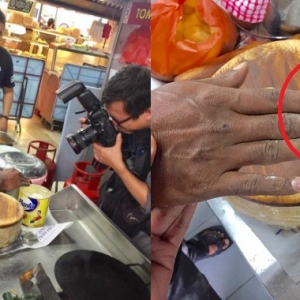 Tukang Uli Tangan Berkudis Bukan Pekerja Nasi Kandar Pelita