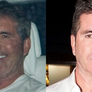 Muka Bengkak Simon Cowell Undang Tanda Tanya