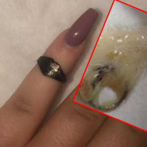 Wanita Bersin Keluar Cincin Yang Hilang 12 Tahun Dulu