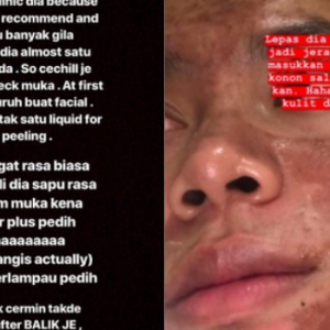 Pusat Rawatan Kulit Ternama Tipu 'Customer' Guna Selebriti Dan Insta Famous