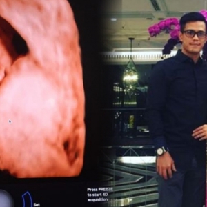 Kandungan Dah Masuk 6 Bulan, Izreen Aminda Kongsi Video Ultrasound..