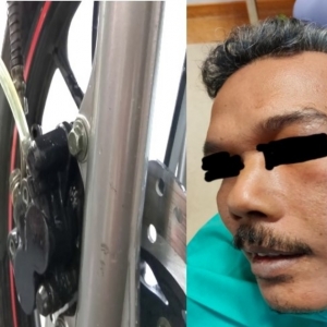 Padah Guna Minyak Brek Motor Rawat Sakit Gigi, Tak Pasal-Pasal Pipi Berlubang