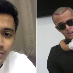 Aliff Aziz Buka Semula Ruangan Komen, Terima Segala Hinaan Netizen