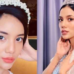 "Bibir Macam Cucuk Je?" - Netizen 'Speku' Sweet Qismina 'Buat' Bibir