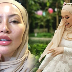 Muka Macam Mona Fandey, Catriona Ross Dituduh Buat Pembedahan Plastik?