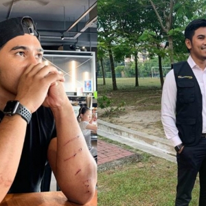 "PU Abu Kena Belasah?" - Upload Gambar Tangan Kena Hiris, Warganet Bukan Kesian Tapi Melahar