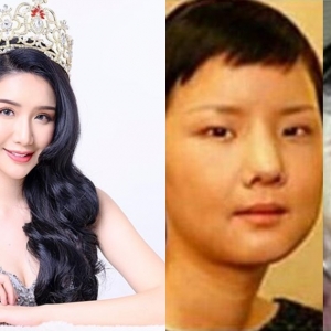 Miss International Malaysia Bengang Dituduh Buat Pembedahan Plastik