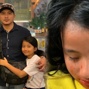 "Hampir Pitam Tengok Jari Putus,"-Netizen Terkejut Lihat Gambar Anak Aaron Aziz